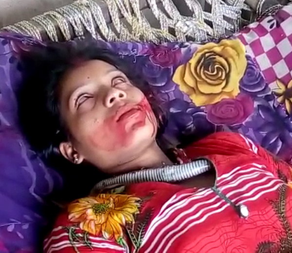 ଯୁବତୀ ବେକରେ ସାପ : ଦୈବୀଶକ୍ତି 